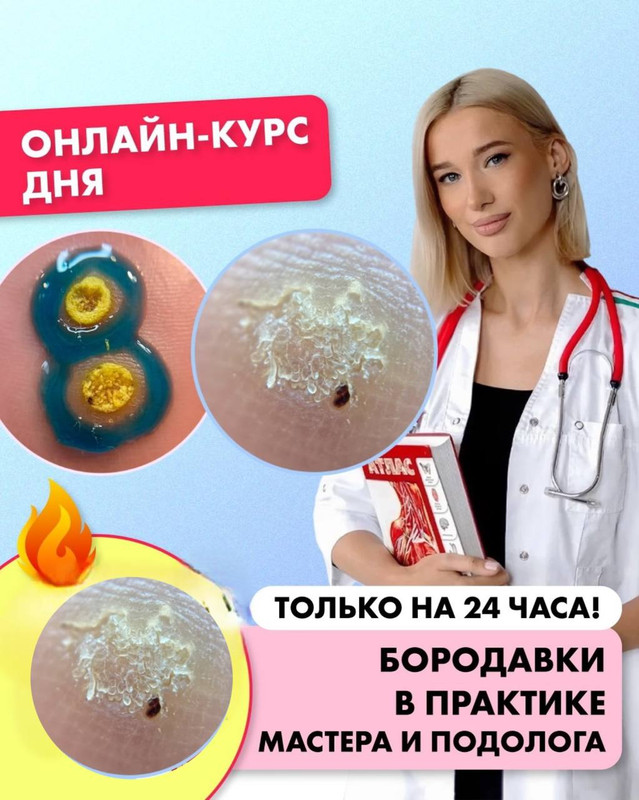 ParisNail School / Ангелина Нышонкова - Бородавки в практике мастера и подолога