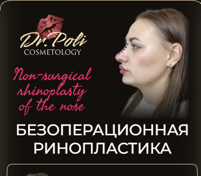 dr.poli / Полина Еремина - Безоперационная ринопластика